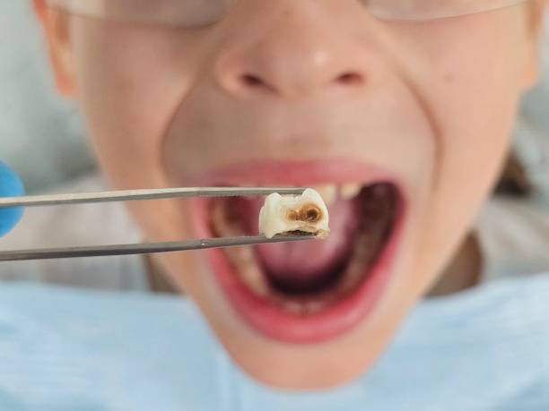 Best Emergency Dental Care for Sports Injuries in Shrub Oak, NY